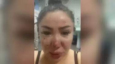 "Қорлық көргенімнің видеосы бар": Жанқош Тұраровқа айып таққан Әнару Қалдыбек тағы үн қатты (ВИДЕО)